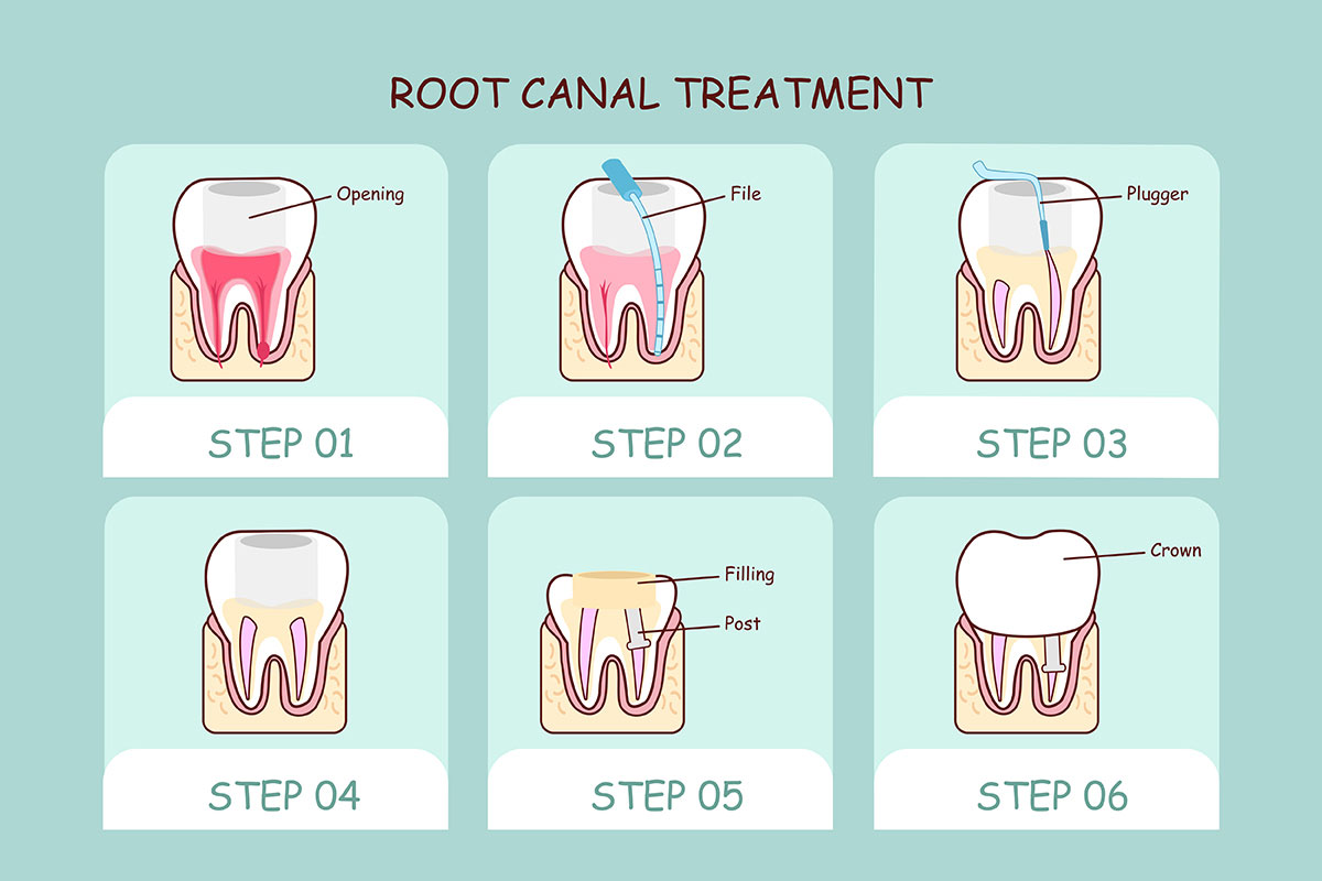 Dentist TX Beaumont