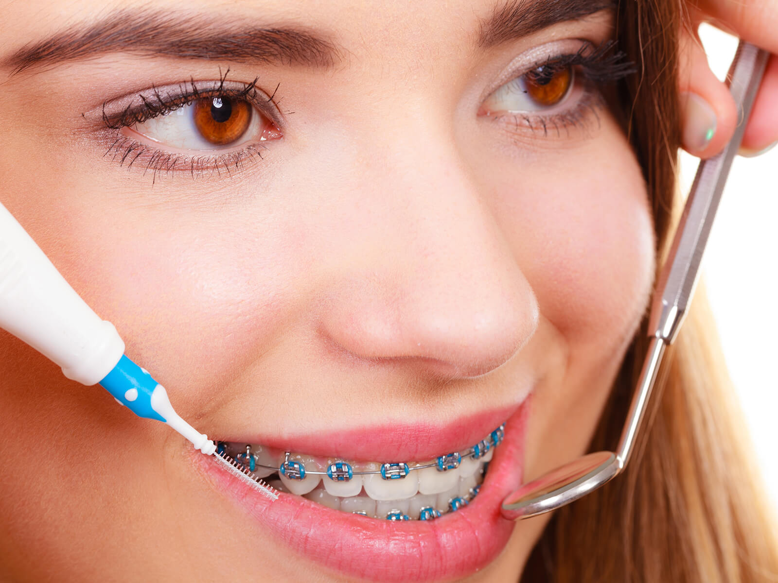 Elastics for Braces - Everything You Need to Know - Magic Smiles