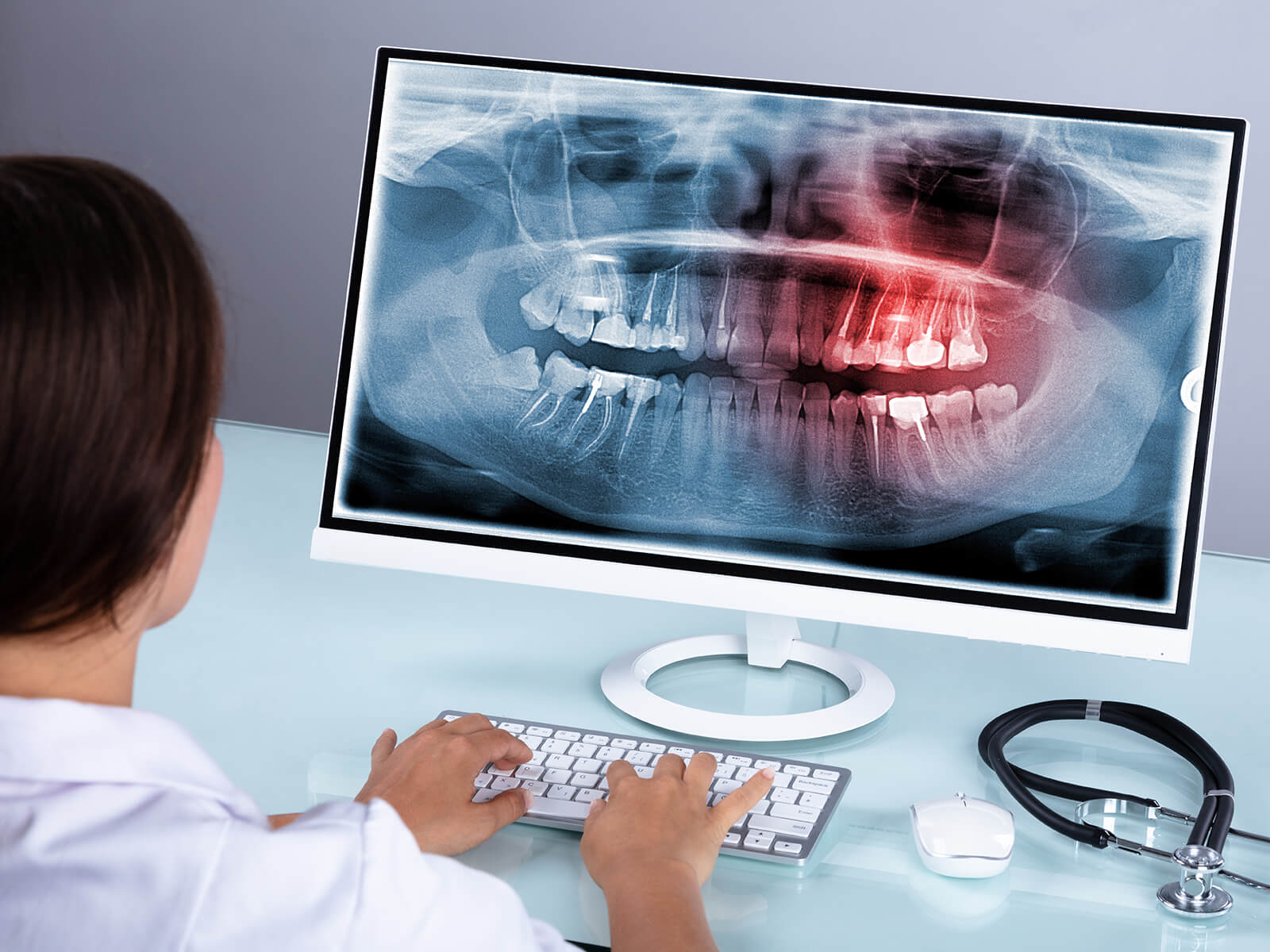 Are Too Many Dental X-Rays Harmful?