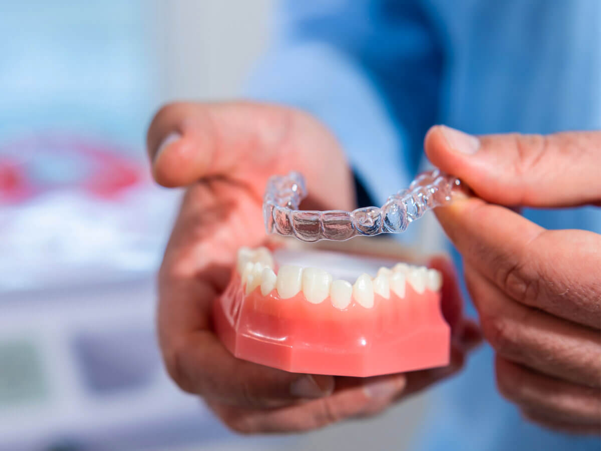 How often Should You Change Your Invisalign Trays?
