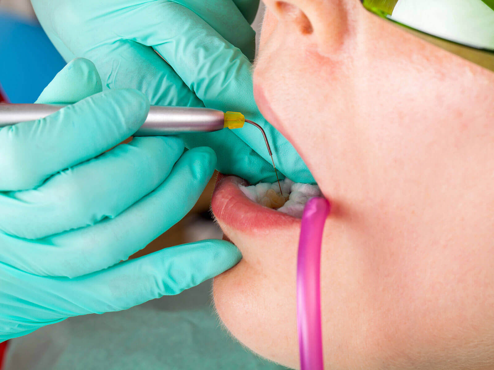 How Laser Dentistry Can Help Gum Disease