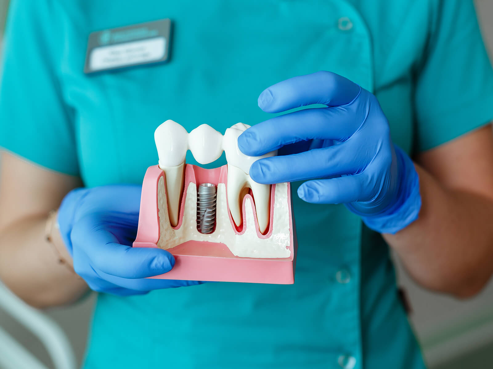 How Dental Implants Can Improve Your Quality of Life