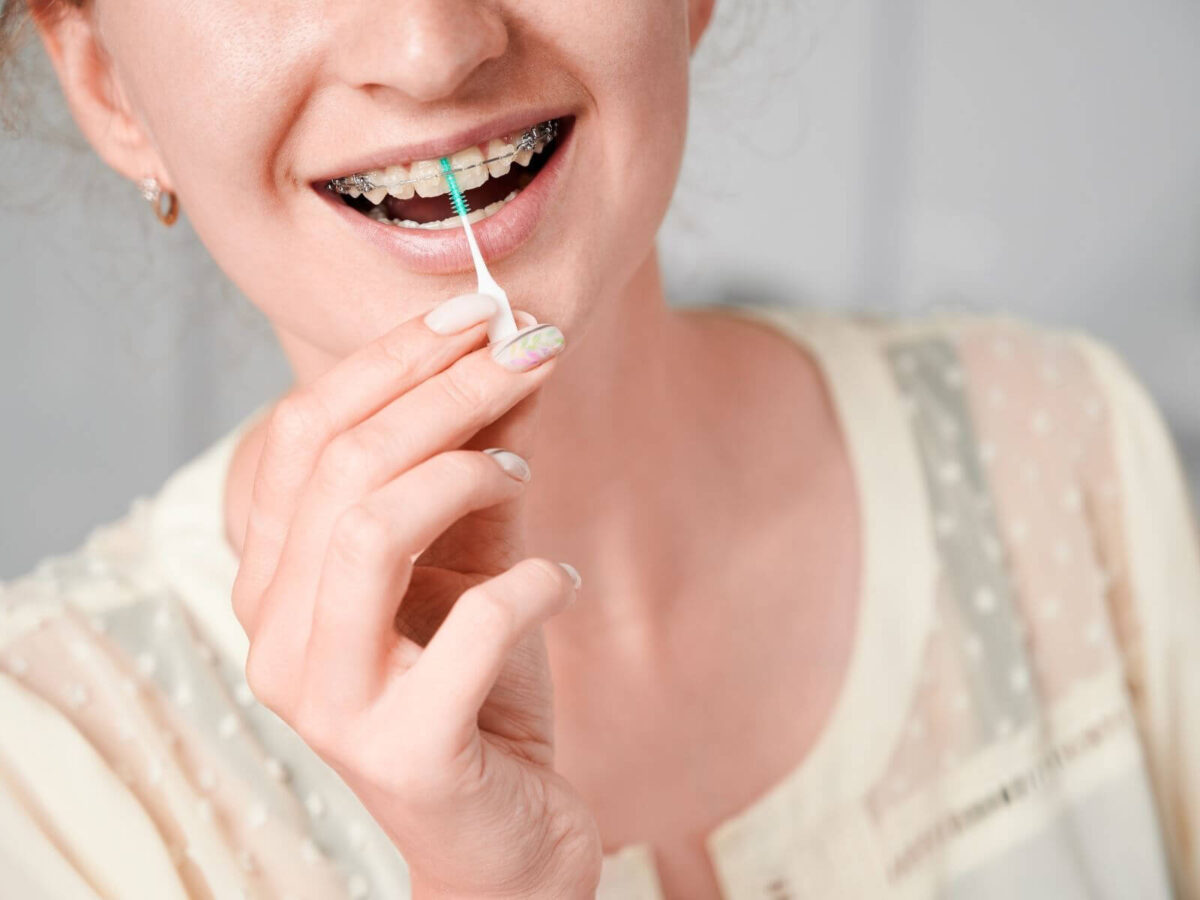Why Regular Cleaning Matters More With Braces