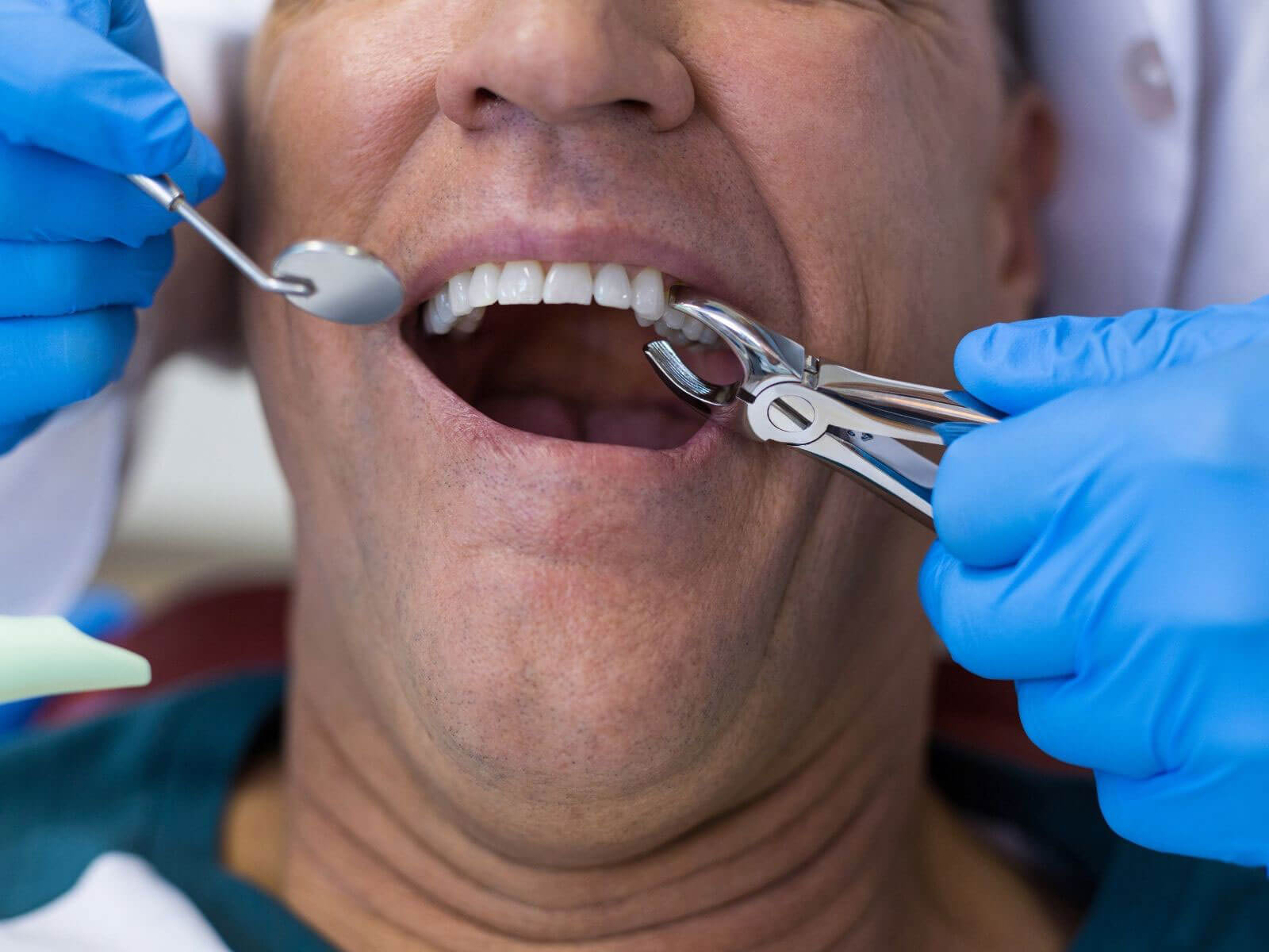 Same-Day Tooth Extraction And Implant: What Patients Need To Know