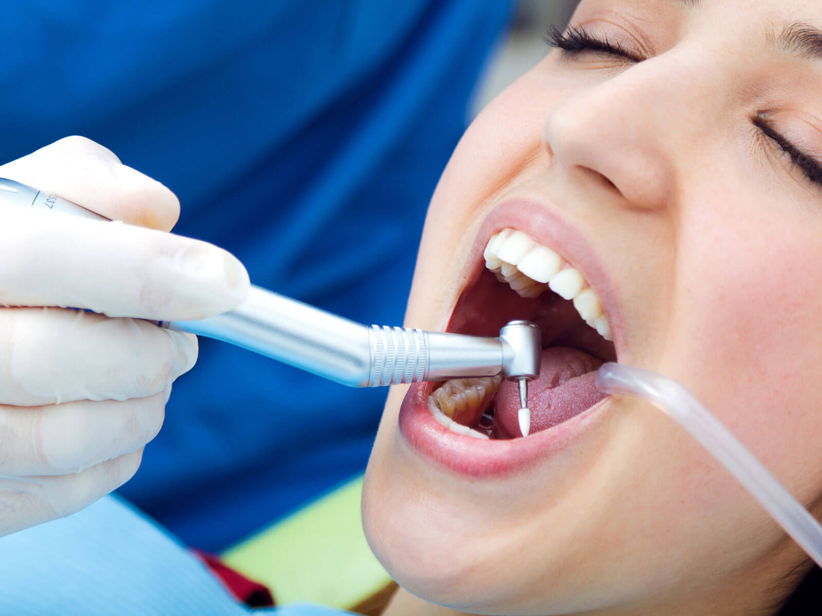 How to Remove Plaque From Teeth: Effective Methods That Work